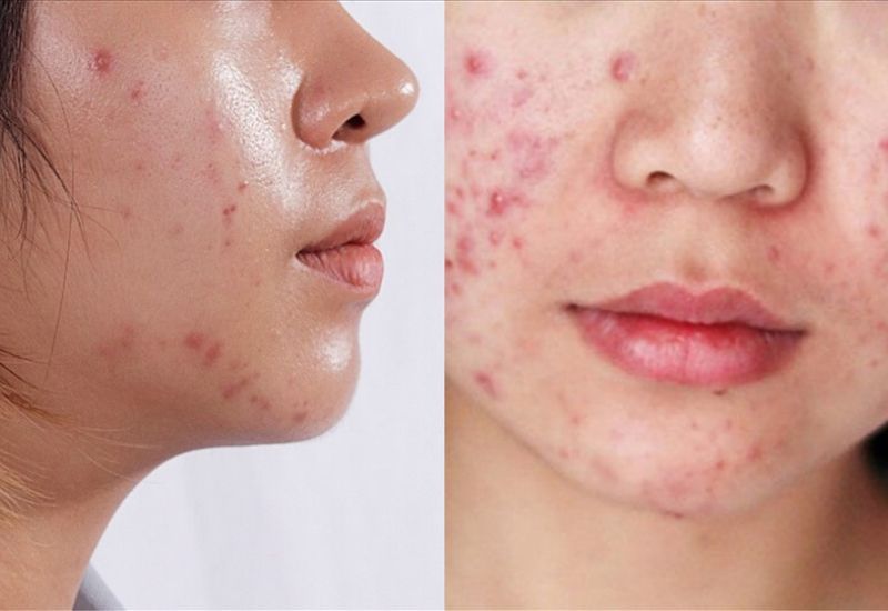 cách nhận biết loại da