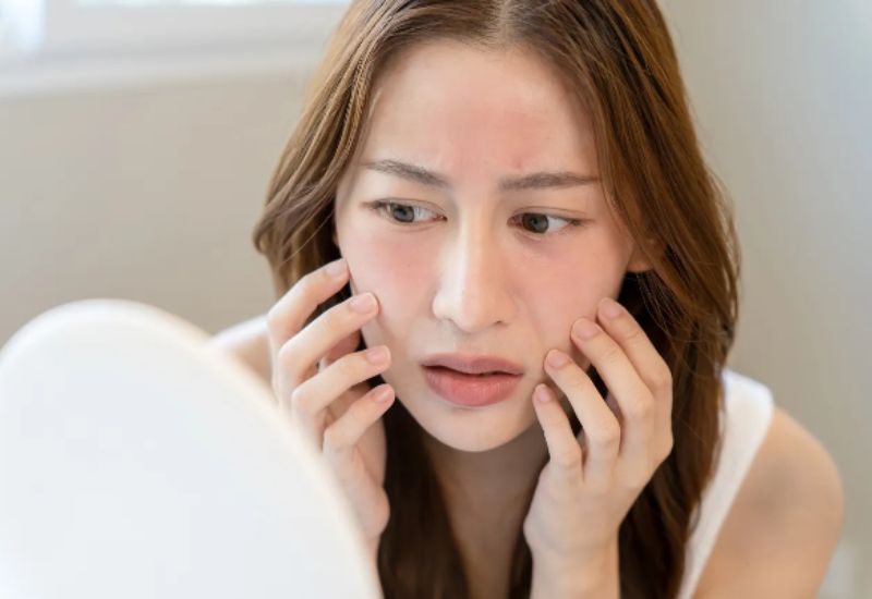 có những loại da nào