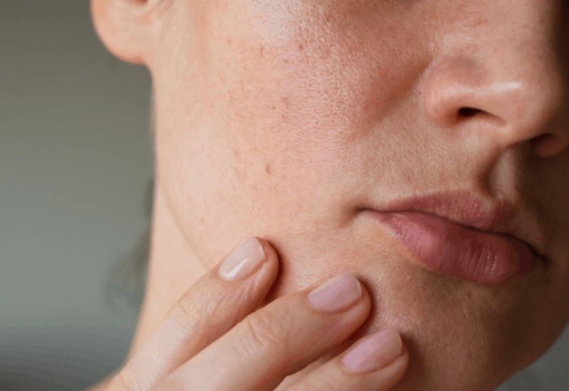 cách nhận biết da