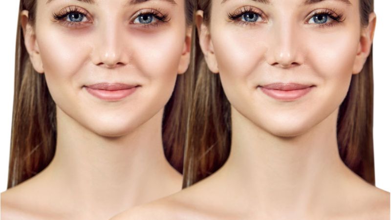 che quầng thâm mắt hiệu quả