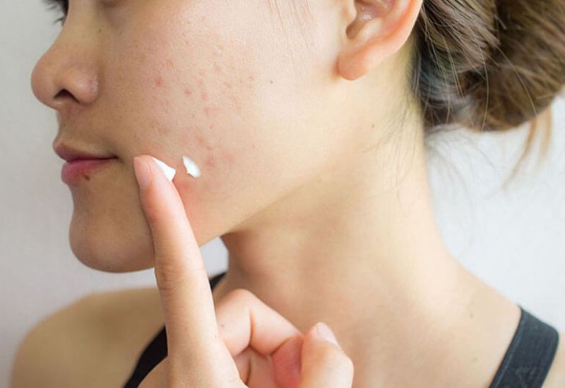 chỉ dùng kem che khuyết điểm được không