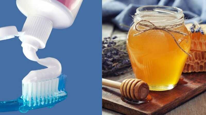 kem đánh răng có trị mụn đầu đen không
