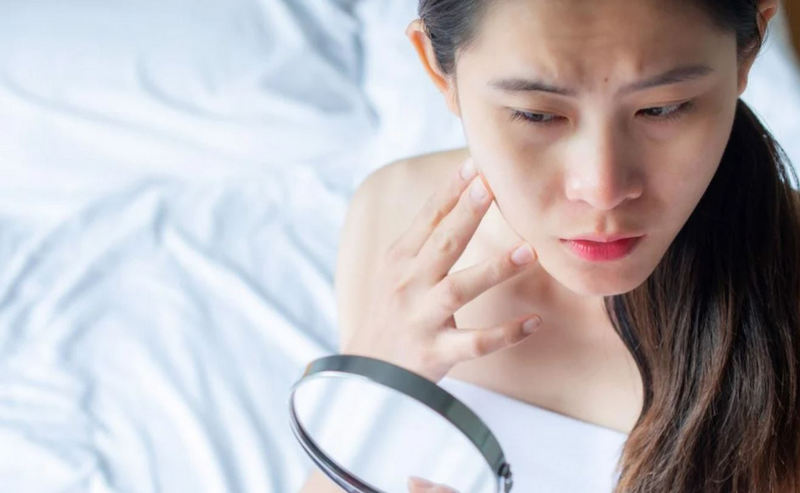 chống lão hóa da tuổi 30
