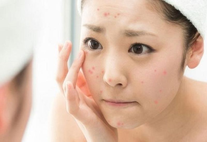 một ngày nên dùng sữa rửa mặt bao nhiêu lần
