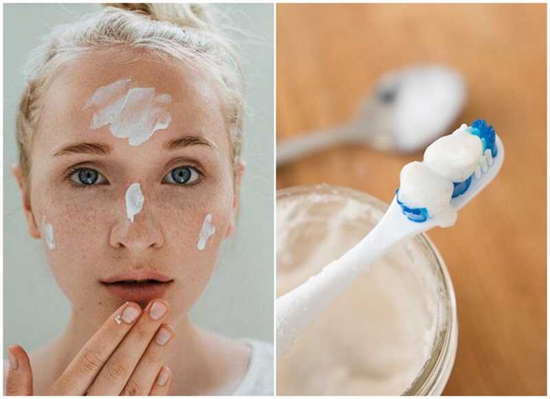 trị mụn đầu đen bằng kem đánh răng với muối