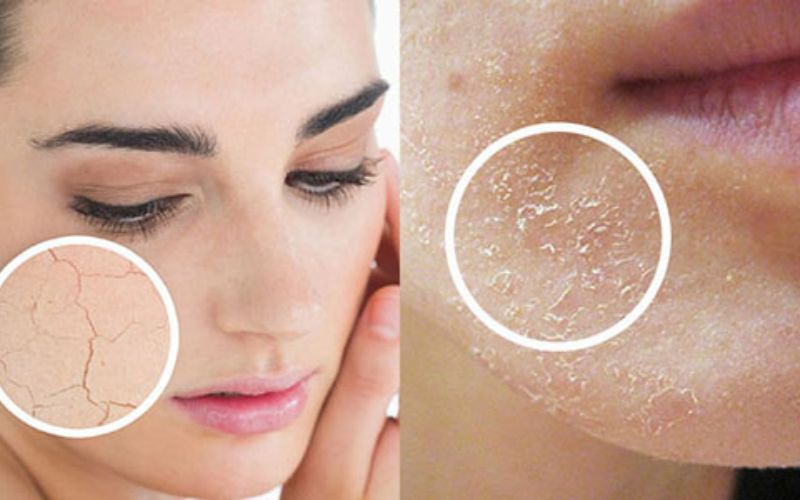 cách trang điểm nền không bị mốc
