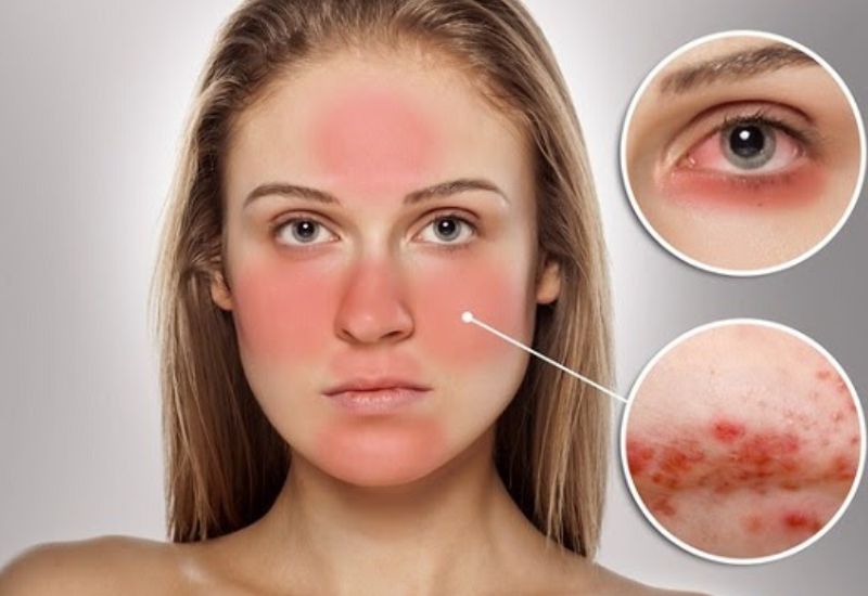 cách chọn tông màu kem che khuyết điểm