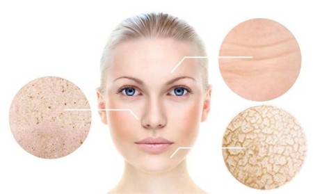 Da khô là như thế nào? Nguyên nhân và cách chăm sóc hiệu quả